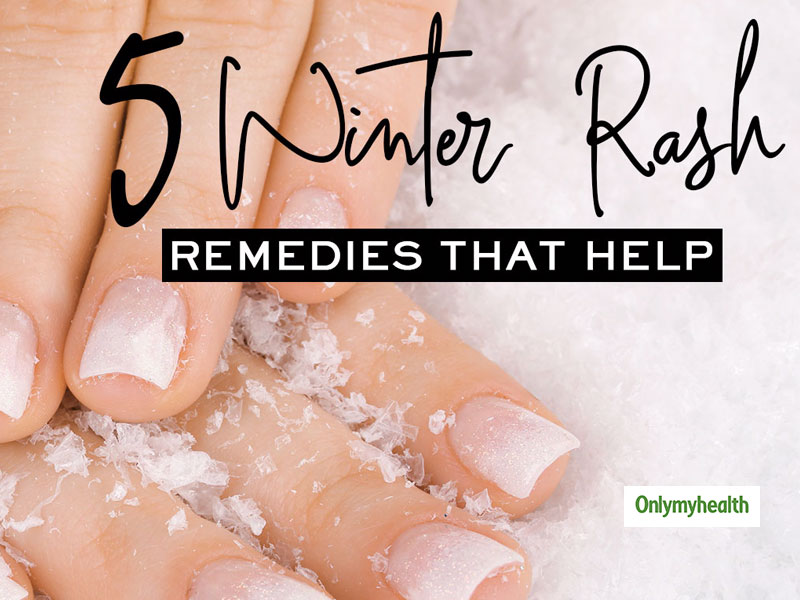 winter-rash-what-leads-to-winter-rashes-and-ways-to-get-rid-of-this